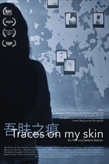 On My Skin